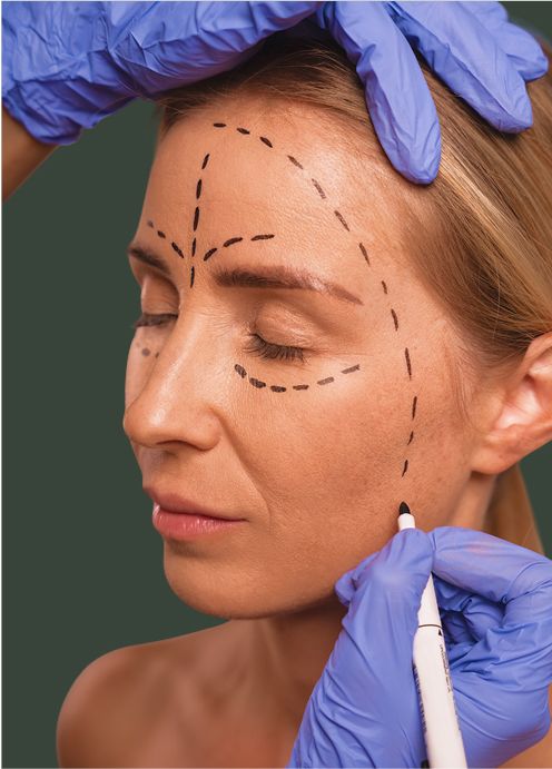 Lifting não cirúrgico